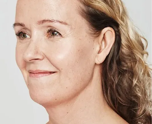 A profile close-up of a middle-aged woman smiling with healthy, glowing skin. Her hair is light brown and curly.