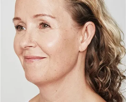 A profile close-up of a middle-aged woman smiling with healthy, glowing skin. Her hair is light brown and curly.